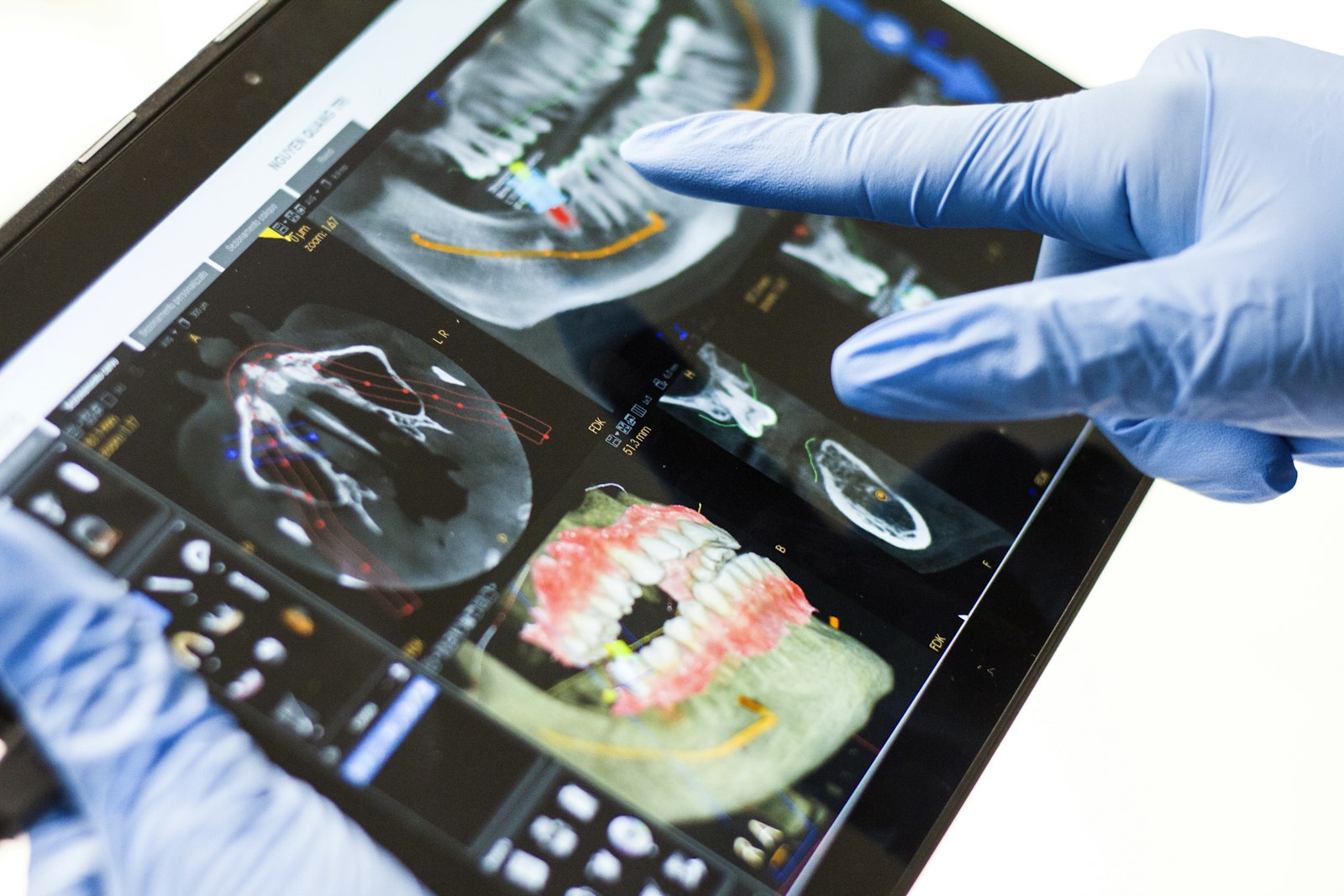 Gloved hands reviewing dental scans on a tablet